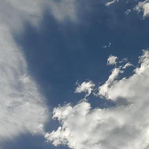 阿尔兹海默的爱