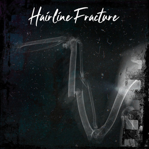 Hairline Fracture