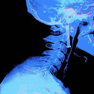 What We Want (Nate Glyn Remix)