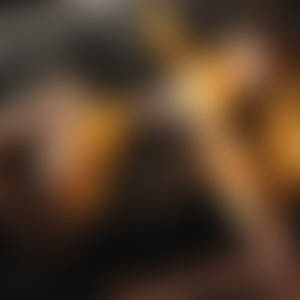 *** on Fire (Vijay & Sofia Zlatko Remix)