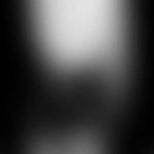 Gar Albern Es Uns Totgebar