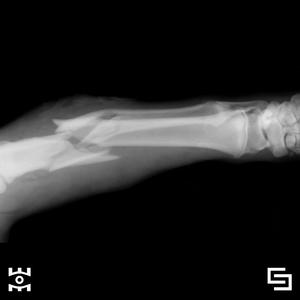 Bone Shattered