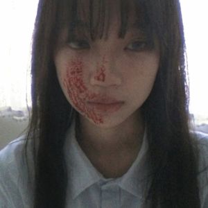 漸凍症 （不懂愛Pt.3）