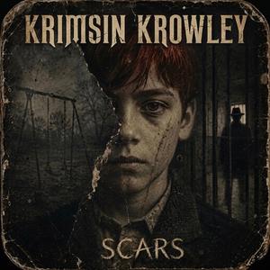 Scars