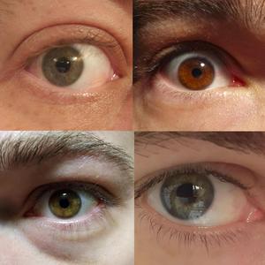 Dust Mites In My Eyes