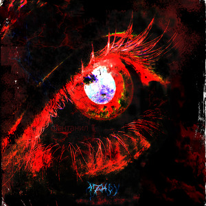 Glaucoma
