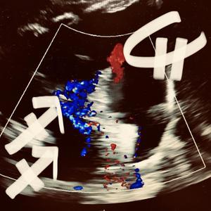 CHASING ALLEYWAYS (feat. Serene)