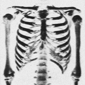 Skeleton