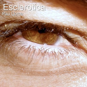 Esclerotica