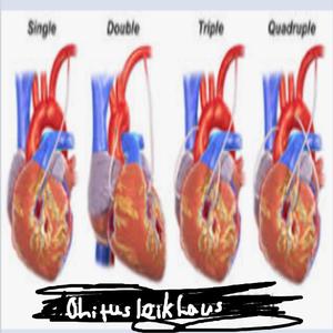 Ohitusleikkaus (feat. Nestori & Yrkkä)