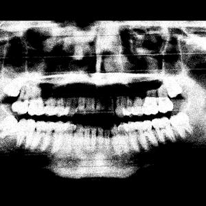 Hollow Point (feat. Blood of Aza)