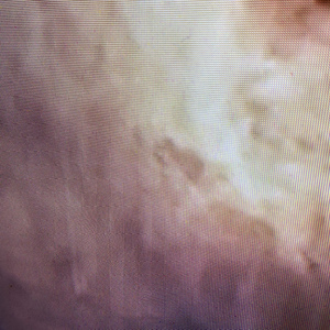 Пигментация (Tape Version)