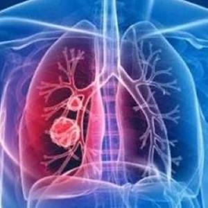 【Free】武汉加油