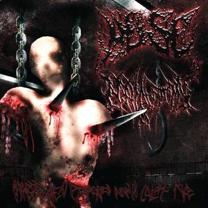 Stabbed Then Dragged Down Colfax Ave (feat. Nephrectomy)