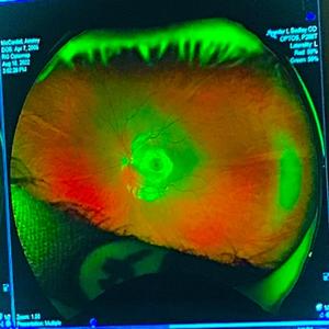 killemall (feat. KTARAE & Gleem)