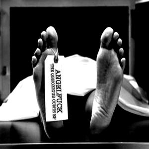 Disgorging Prolapseotomy