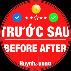 TRƯỚC SAU - BEFORE AFTER