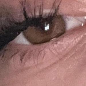 Spark in your eye