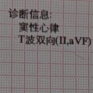 Depression=Best friend