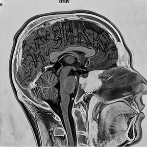 хліба та видовищ
