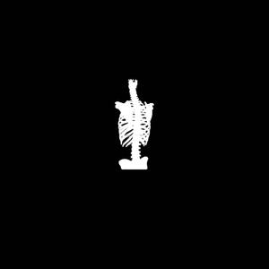 Sciatica