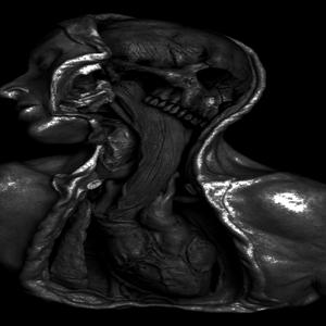 Parasite neural