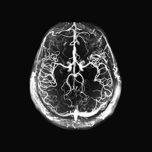 trojan horse (feat. MO$h)