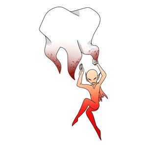 Cavities