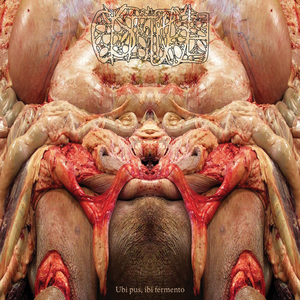 Empyema Thoracis: Suctioning Fungal Effusion, Decorticating Myconeoplasmic Masses I