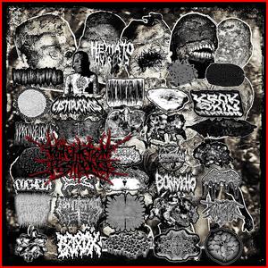 Surgical and Functional Outcomes of Penile Amputation and Perineal Urethrostomy Configuration in Invasive Penile Cancer