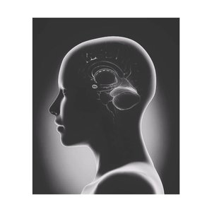 Amygdala
