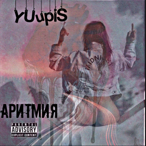 Аритмия