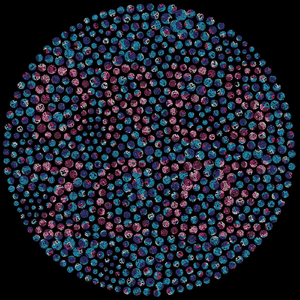 Dreszcze (J'en Ai Assez)