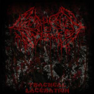 Tracheal Laceration