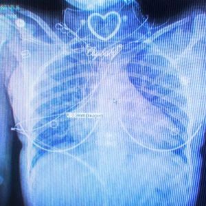 ''ice tea'' powfu x lofi type beat