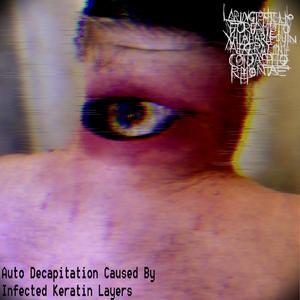 This Teratoma Looks Like My Ex