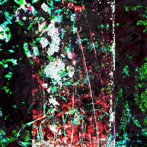 Dopamine