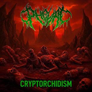 Cryptorchidism