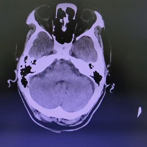 标志笋子是一家