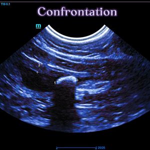 Воздух — Поверхность