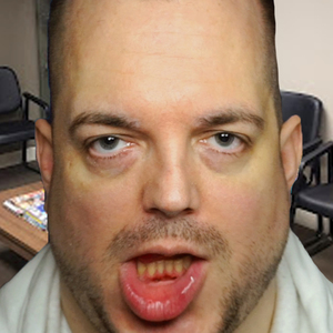 Cranial Nerve Exam 1