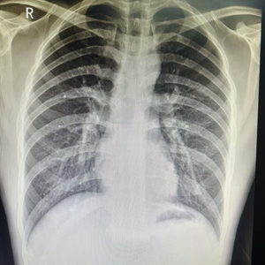 深夜空想家-Jacky