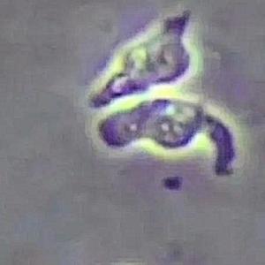 Naegleria Fowleri
