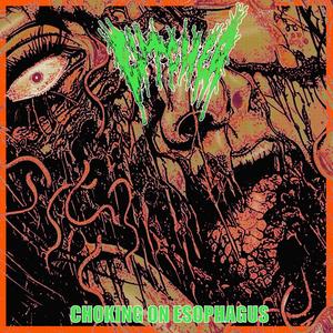 Choking on esophagus