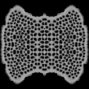 ...epikossyphophattoperisteralektryonoptekephalliokigklopeleiolagoiosiraiobaphetraganopterygon Made Out of Aesthetically Rotten Human Flesh.. (...Harvested From Eviscerated Carcasses) (Split Version)