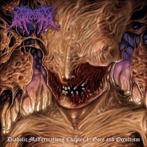 Idiopathic Granulomatous Myocarditis