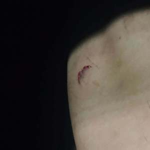 莫伊拉，再次被削弱