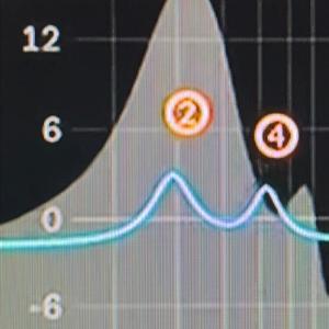 i gotta feeling where it hurts