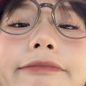 你是我唯一的过敏原