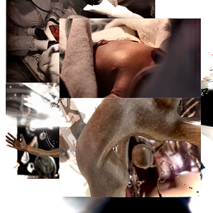 2000年我着床了 / Implantation Year 2000